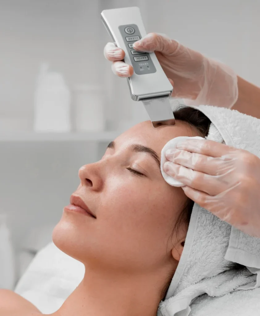 Microneedling Radio Frequency (MNRF)