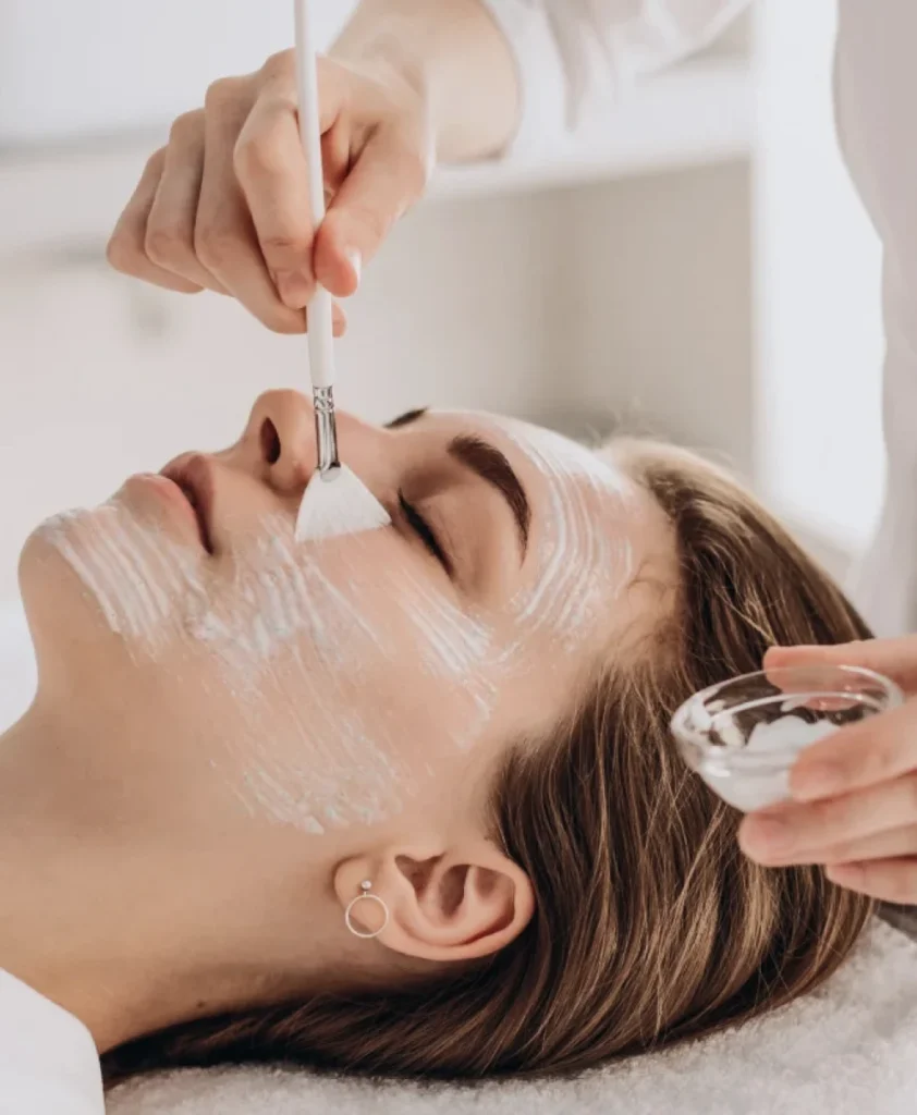 Chemical Peels